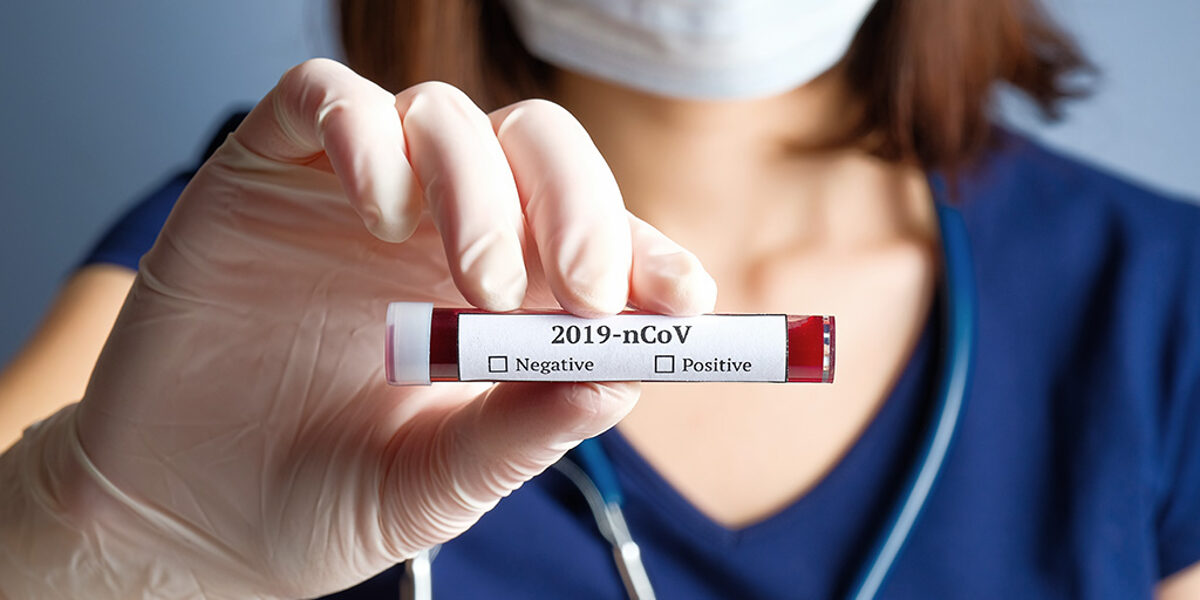 Nurse holding test tube with blood for 2019-nCoV analyzing. Novel Chinese Coronavirus blood test concept Schlagwort(e): coronavirus, blood, test, tube, 2019-ncov, analysis, bacterial, china, chinese, clinic, container, corona, cov, death, diagnostic, disease, doctor, epidemic, equipment, female, flu, hand, health, holding, hospital, infection, lab, laboratory, mask, medical, medicine, mers, microbe, microbiology, ncov, negative, novel, pandemic, patient, pneumonia, positive, research, respiratory, scientist, specimen, vaccine, virology, virus, woman, wuhan, coronavirus, covid-19, 2019-ncov, blood, test, tube, analysis, bacterial, china, chinese, clinic, container, corona, cov, death, diagnostic, disease, doctor, epidemic, equipment, female, flu, hand, health, holding, hospital, infection, lab, laboratory, mask, medical, medicine, mers, microbe, microbiology, ncov, negative, novel, pandemic, patient, pneumonia, positive, research, respiratory, scientist, specimen, vaccine, virus, woman, wuhan