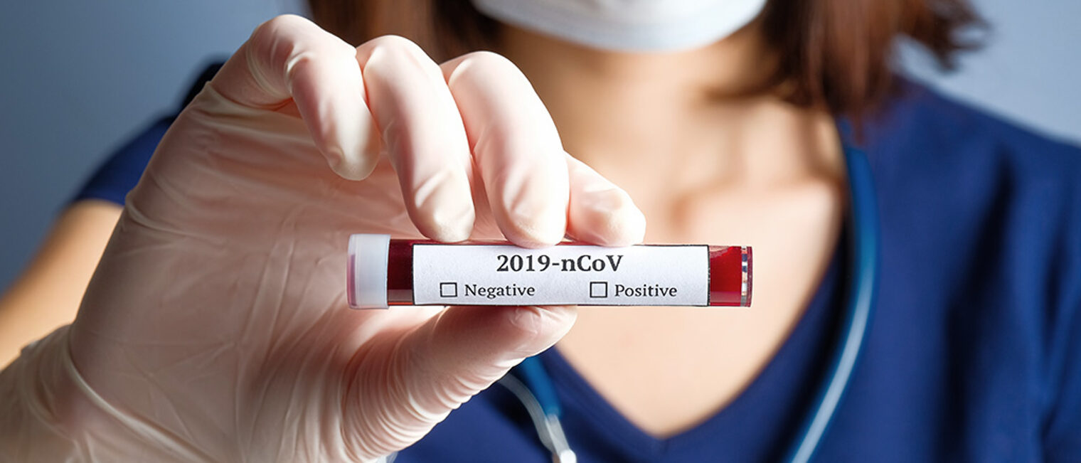 Nurse holding test tube with blood for 2019-nCoV analyzing. Novel Chinese Coronavirus blood test concept Schlagwort(e): coronavirus, blood, test, tube, 2019-ncov, analysis, bacterial, china, chinese, clinic, container, corona, cov, death, diagnostic, disease, doctor, epidemic, equipment, female, flu, hand, health, holding, hospital, infection, lab, laboratory, mask, medical, medicine, mers, microbe, microbiology, ncov, negative, novel, pandemic, patient, pneumonia, positive, research, respiratory, scientist, specimen, vaccine, virology, virus, woman, wuhan, coronavirus, covid-19, 2019-ncov, blood, test, tube, analysis, bacterial, china, chinese, clinic, container, corona, cov, death, diagnostic, disease, doctor, epidemic, equipment, female, flu, hand, health, holding, hospital, infection, lab, laboratory, mask, medical, medicine, mers, microbe, microbiology, ncov, negative, novel, pandemic, patient, pneumonia, positive, research, respiratory, scientist, specimen, vaccine, virus, woman, wuhan